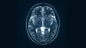 Adicción y adolescencia consumo temprano y desarrollo cerebral
